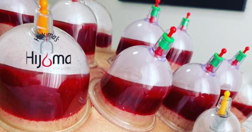 Hijama Treatment