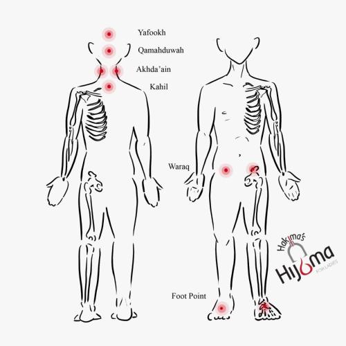 Hijama Points