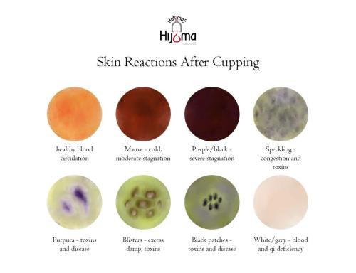 Hijama Skin Reactions