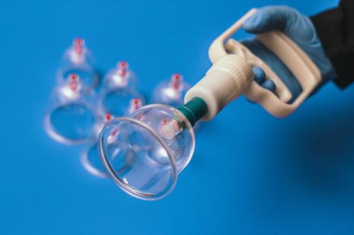 Hijama Treatment