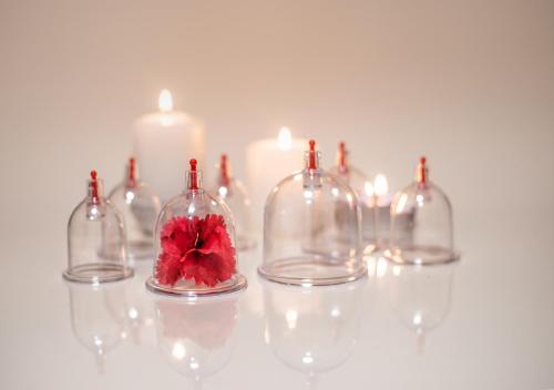 Hijama Cupping