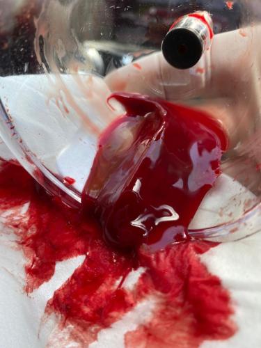 Hijama Treatment Clotting