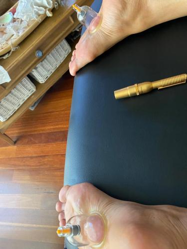 Hijama Medical Tools